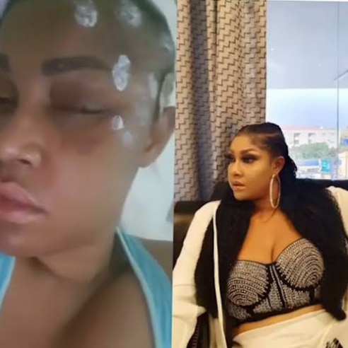 Angela Okorie Reveals Bullet Fragments Still in Her Head - Nigeria Gossip and Scandals